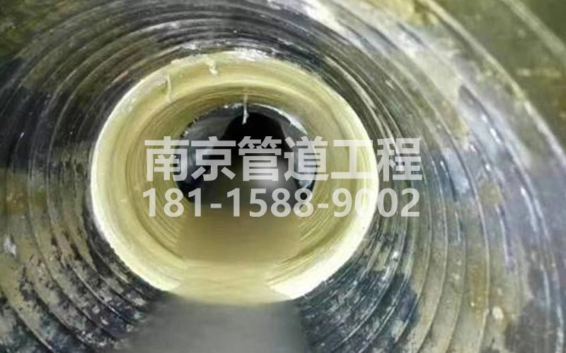 嘉定树脂修复